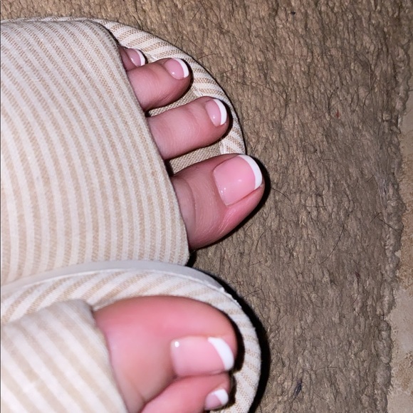 STRIPED SLIDES - Picture 5 of 12